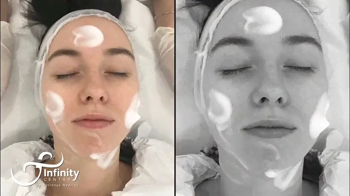 Juliette Armand - skin boosters Chronos therapy