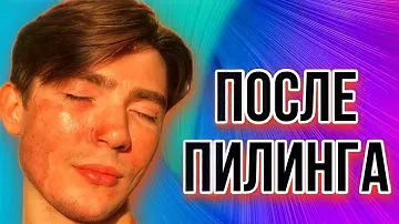 После срединного химического пилинга | Уход за кожей после пилинга | ТСА пилинг 20%